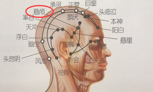 悬颅的准确位置图 悬颅的准确位置图片