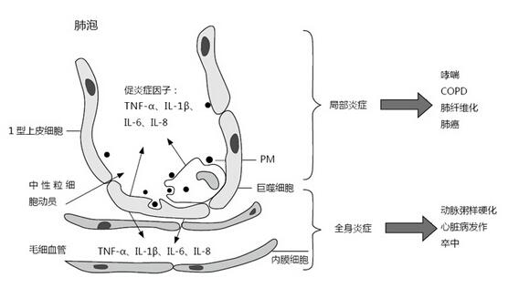 雾霾到底会不会致癌 雾霾会导致癌症吗