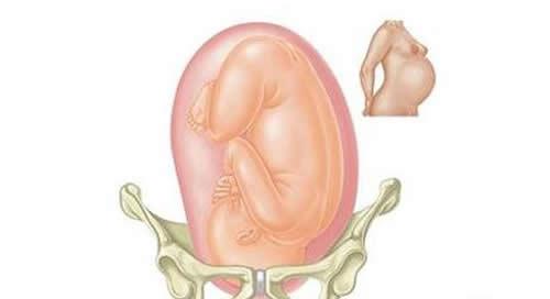 胎儿没入盆能顺产吗 胎儿没有入盆可以顺产吗