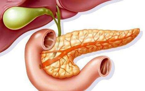 怎么会得急性胰腺炎（怎么会得急性胰腺炎症）