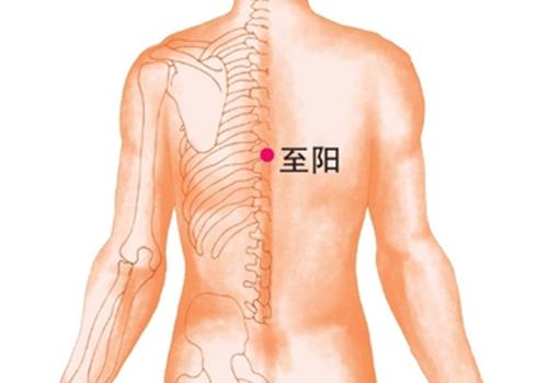 男性拔罐的位置图图解（男生拔罐位置图解）