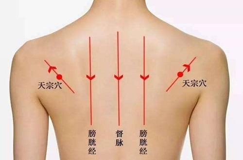 拔罐后背的位置示意图（拔罐后背位置图解）