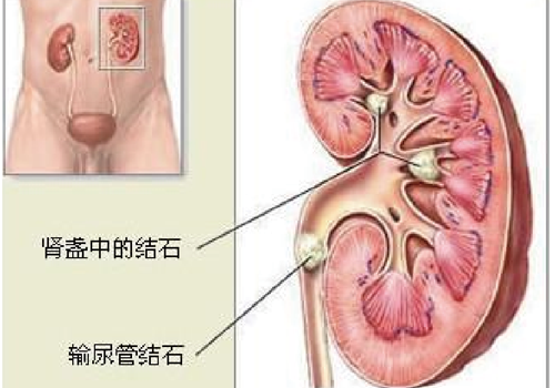 肚子胀尿少怎么回事 肚子胀尿的少怎么回事