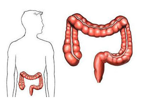 肠癌的早期症状 肠癌的早期症状及表现