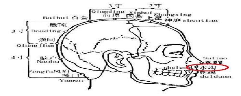 水沟的针刺方法（水沟的针刺方法视频）