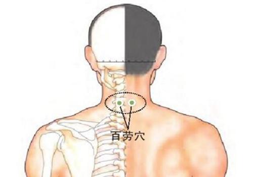 阴囊湿疹会出现脱皮吗 阴囊湿疹脱皮是要好的表现嘛