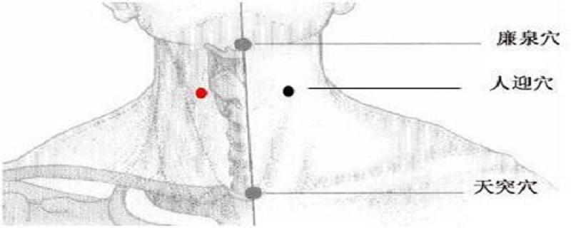 人迎针刺方法（人迎气口针法）