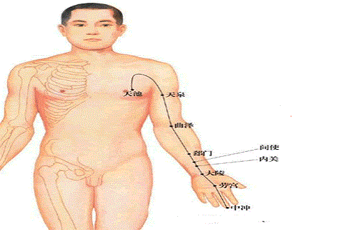 心包经不通的症状（心包经不通的常见症状）