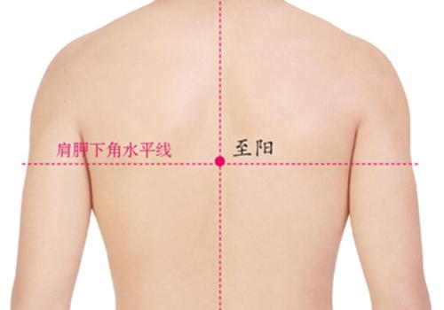 心绞痛拔罐位置图（心脏拔罐的位置图）