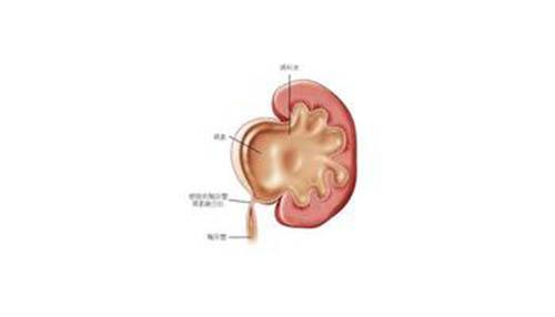 肾积水有哪些症状 肾积水有哪些症状 女性