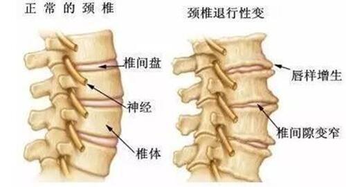 腰酸背痛是什么原因引起的 坐月子腰酸背痛是什么原因引起的