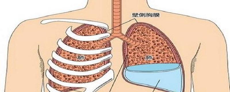 胸腔积液的症状有哪些（胸腔积液的症状有哪些会导致喉咙发炎不舒服吗）