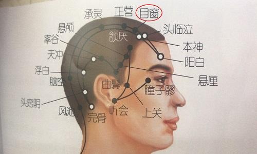 目窗的准确位置图（目窗的准确位置图和作用）