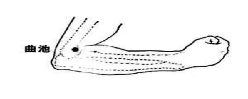 曲池针刺方法（曲池怎样扎针）