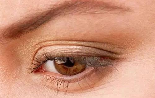 眼皮肿怎么办 上眼皮浮肿是什么原因引起的