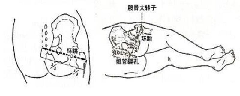 环跳的准确位置图视频（环跳的定位视频）