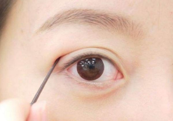 内双怎么贴双眼皮贴 内双贴双眼皮贴的方法