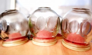 拔罐是什么意思 拔罐简单介绍