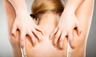 止痒的方法止痒偏方(止痒偏方大全)