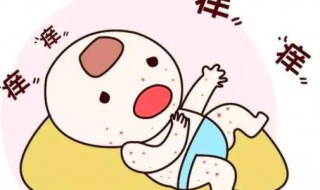 长痱子擦什么好的最快 头上长痱子擦什么好的最快