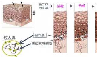 皮肤黑色素怎么去掉 皮肤黑色素沉淀怎么除掉