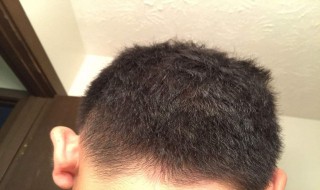 如何消灭头发上的螨虫 如何消灭头发上的螨虫和螨虫