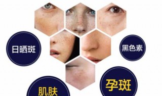 祛雀斑的方法有哪些（祛雀斑的方法有哪些呢）