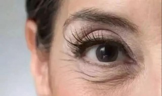 有了眼纹眼袋怎么办 有了眼纹眼袋怎么办图片