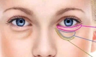 怎样最有效去除眼袋（怎样最有效去除眼袋和皱纹）