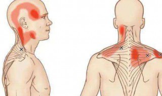斜方肌是怎么造成的 斜方肌厚怎么减下来