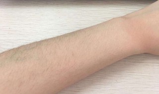 汗毛多怎么去除 腿上汗毛多怎么去除