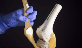 半月板是什么（半月板是什么部位）