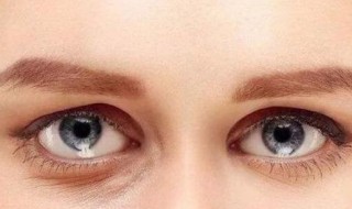 怎么能够去眼袋（怎样能够去眼袋）