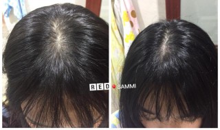 怎样能生发 怎样能生发养发防脱发