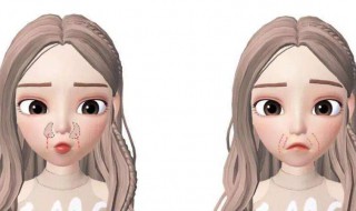 怎样减少法令纹（怎样减少法令纹怎么消除）