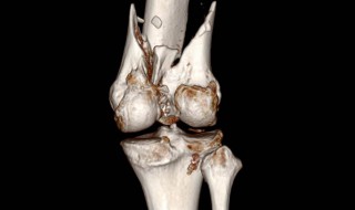 髋臼怎么读(臼怎么读)