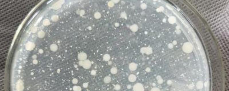 菌落总数标准，菌落总数计数方法 菌落总数的计算方法及报告方法