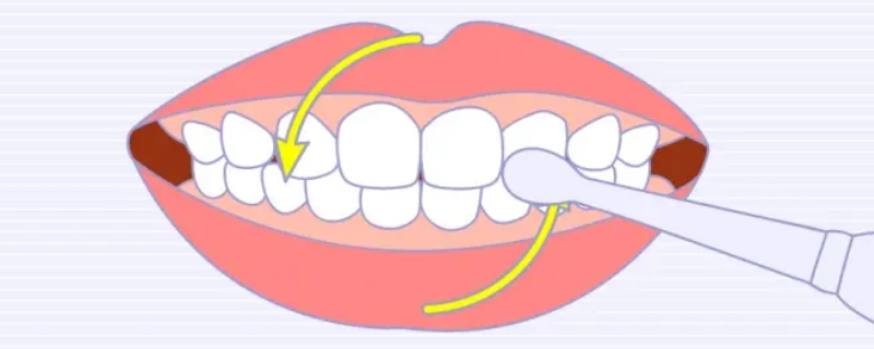 圆弧刷牙法 圆弧刷牙法步骤