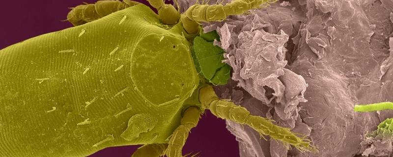 白色会动的小白点是什么虫（白色会动的小白点是什么虫对人有害吗）