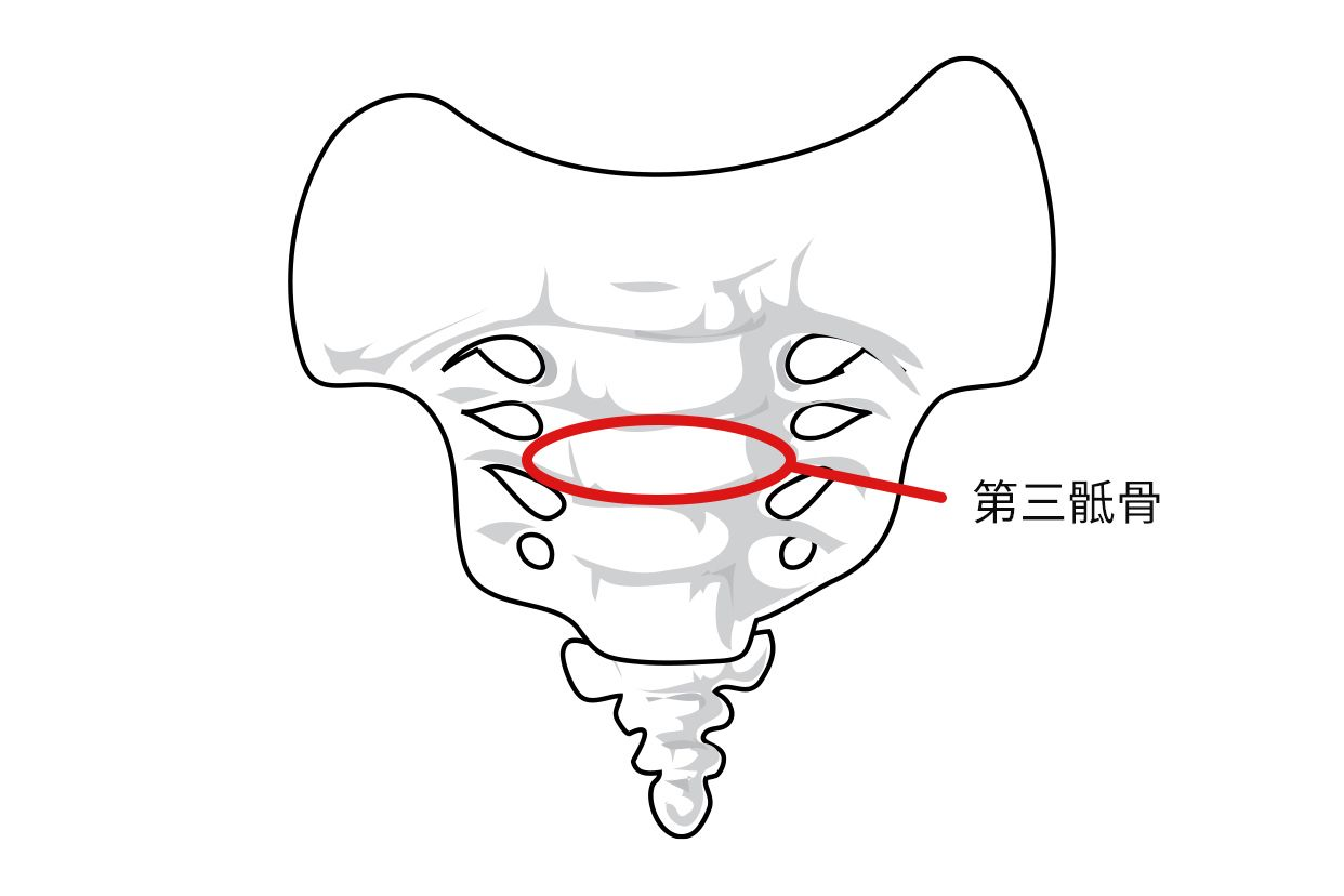 第三骶骨在哪个位置图片 骶3骨在哪个位置图片