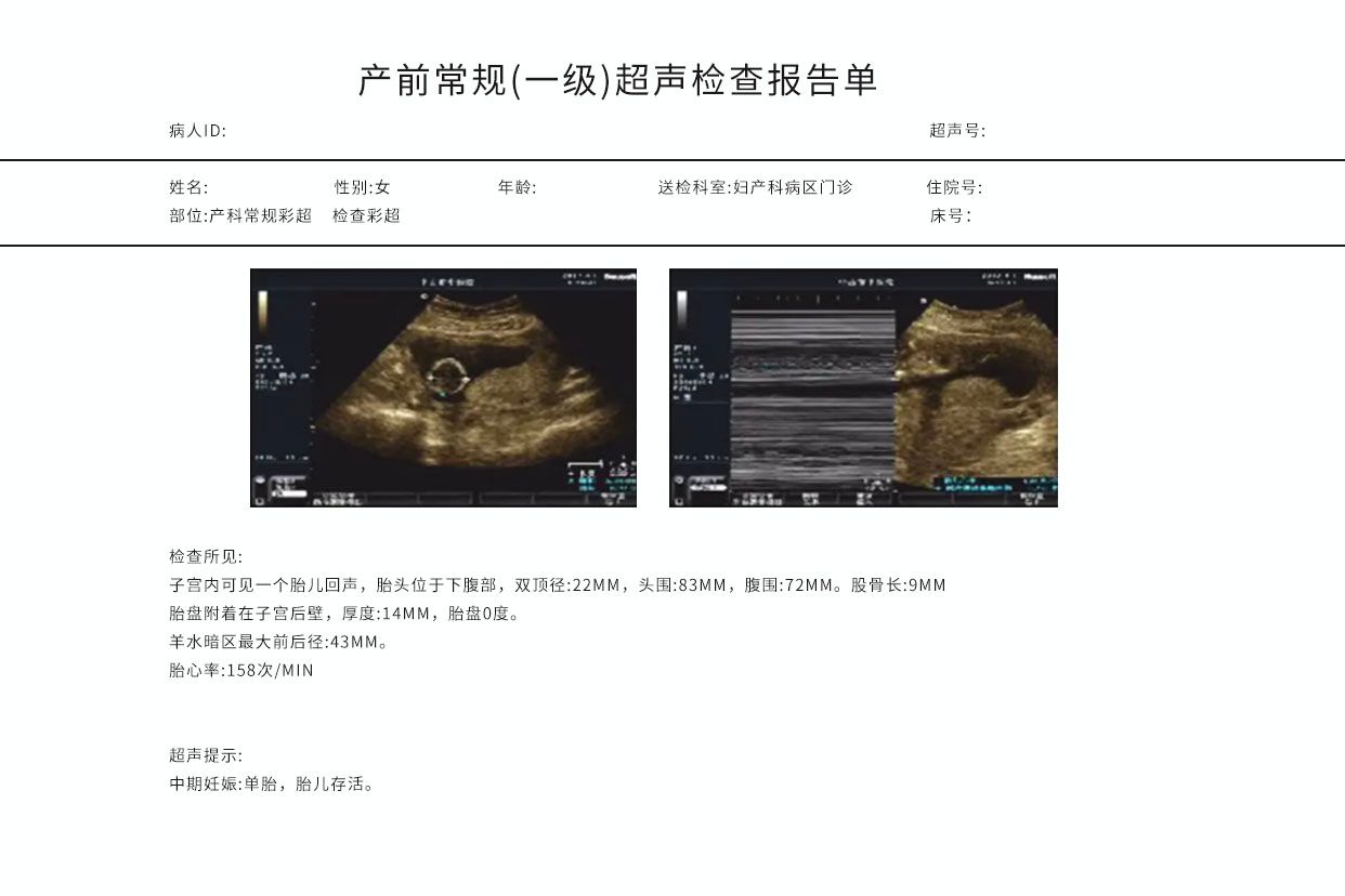 产科彩色超声报告图解（产科彩色超声报告图解大全）