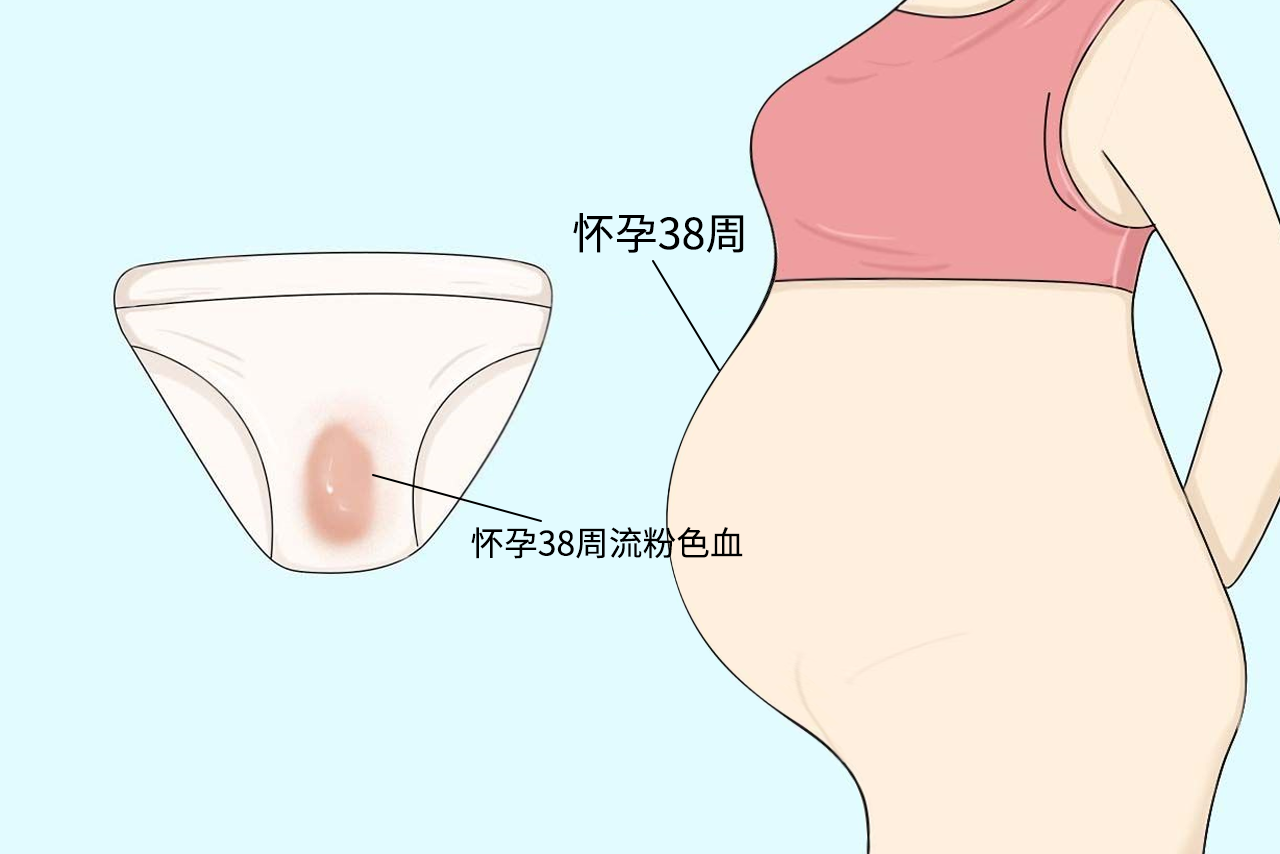 孕38周粉色分泌物图片 孕38周粉色分泌物图片大全