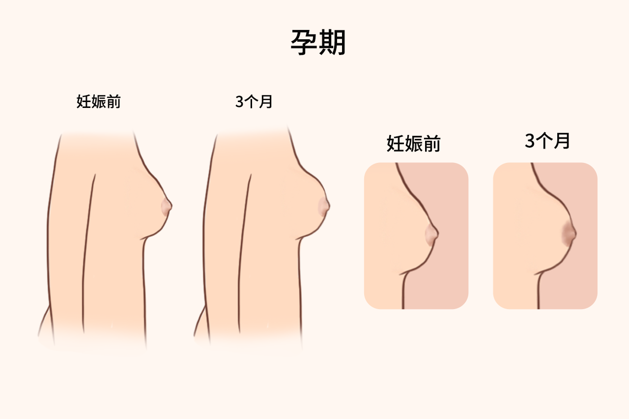 怀孕三个月乳房变化图片 怀孕三个月乳房有什么变化