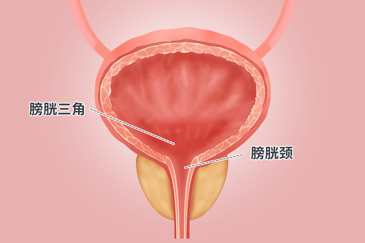 膀胱颈和膀胱三角解剖图 膀胱颈部和膀胱三角区解剖图位置