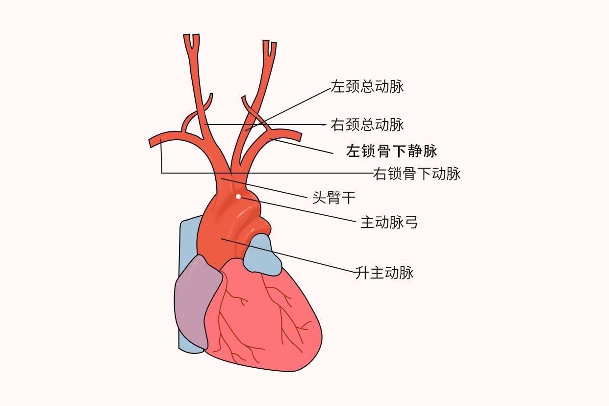 主动脉弓位置示意图（主动脉弓的位置图）