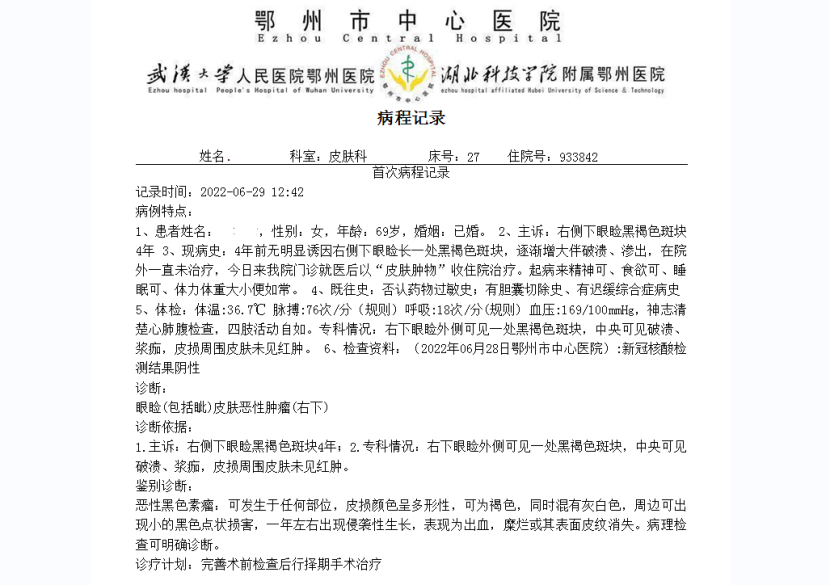 记录69岁患者治疗皮肤肿瘤的经历 皮肤肿瘤治疗学