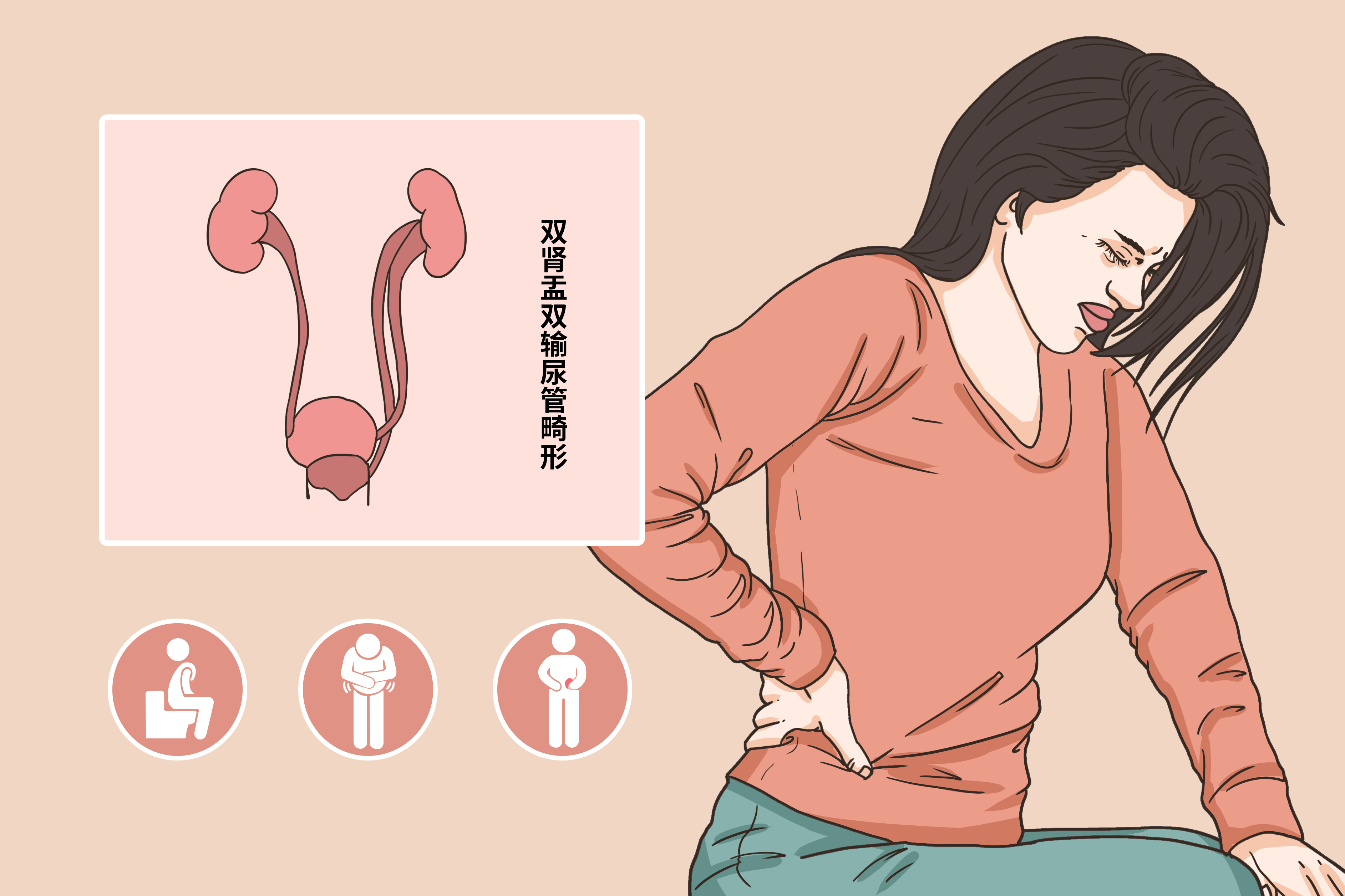 双肾盂双输尿管畸形图片 右肾双肾盂双输尿管畸形