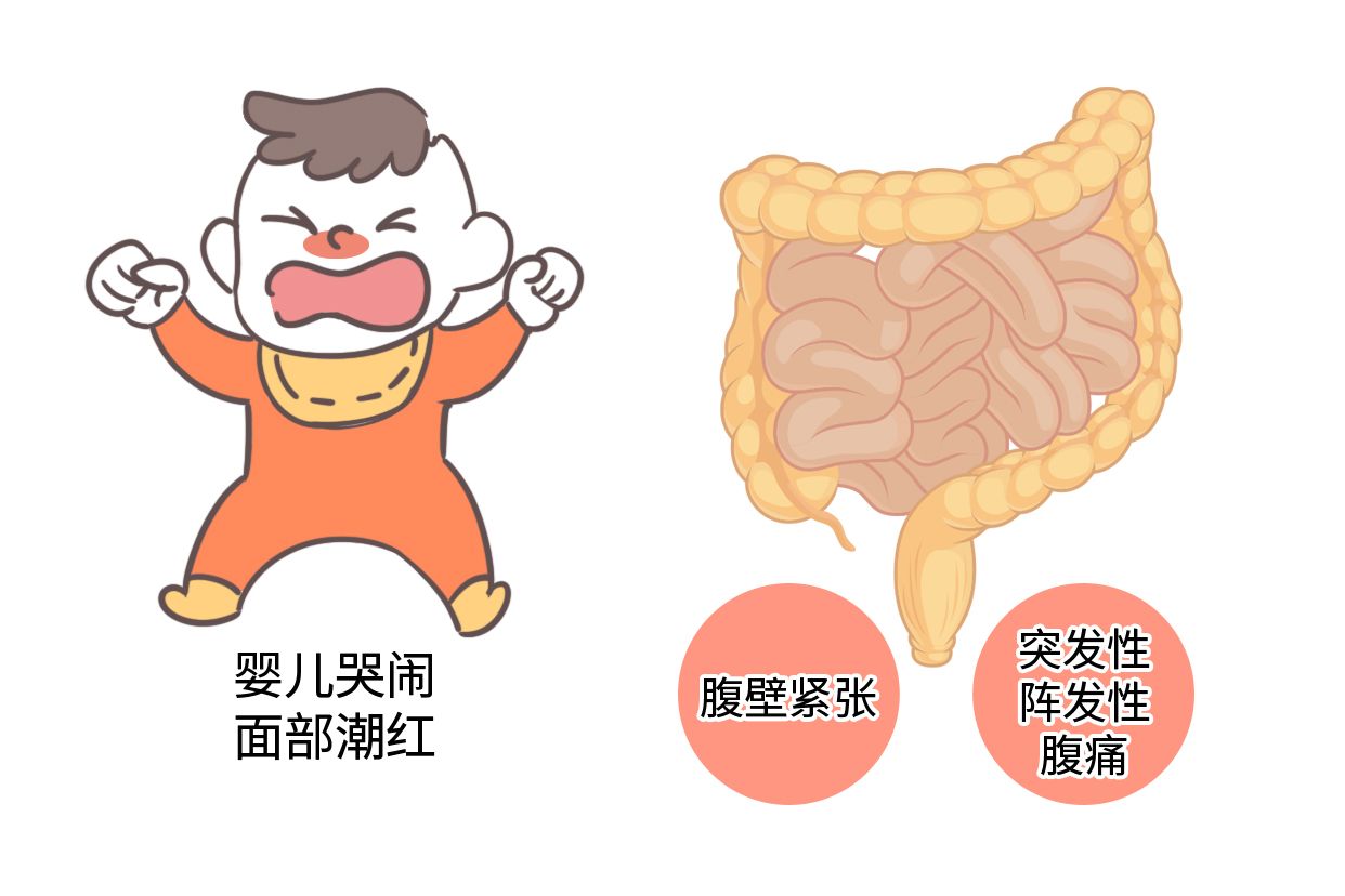 肠痉挛图片（肠痉挛 位置图）