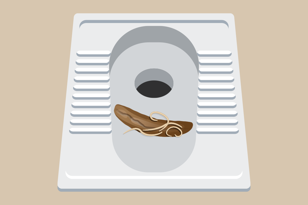 大便拉出的死蛔虫图片（大便中的蛔虫照片）