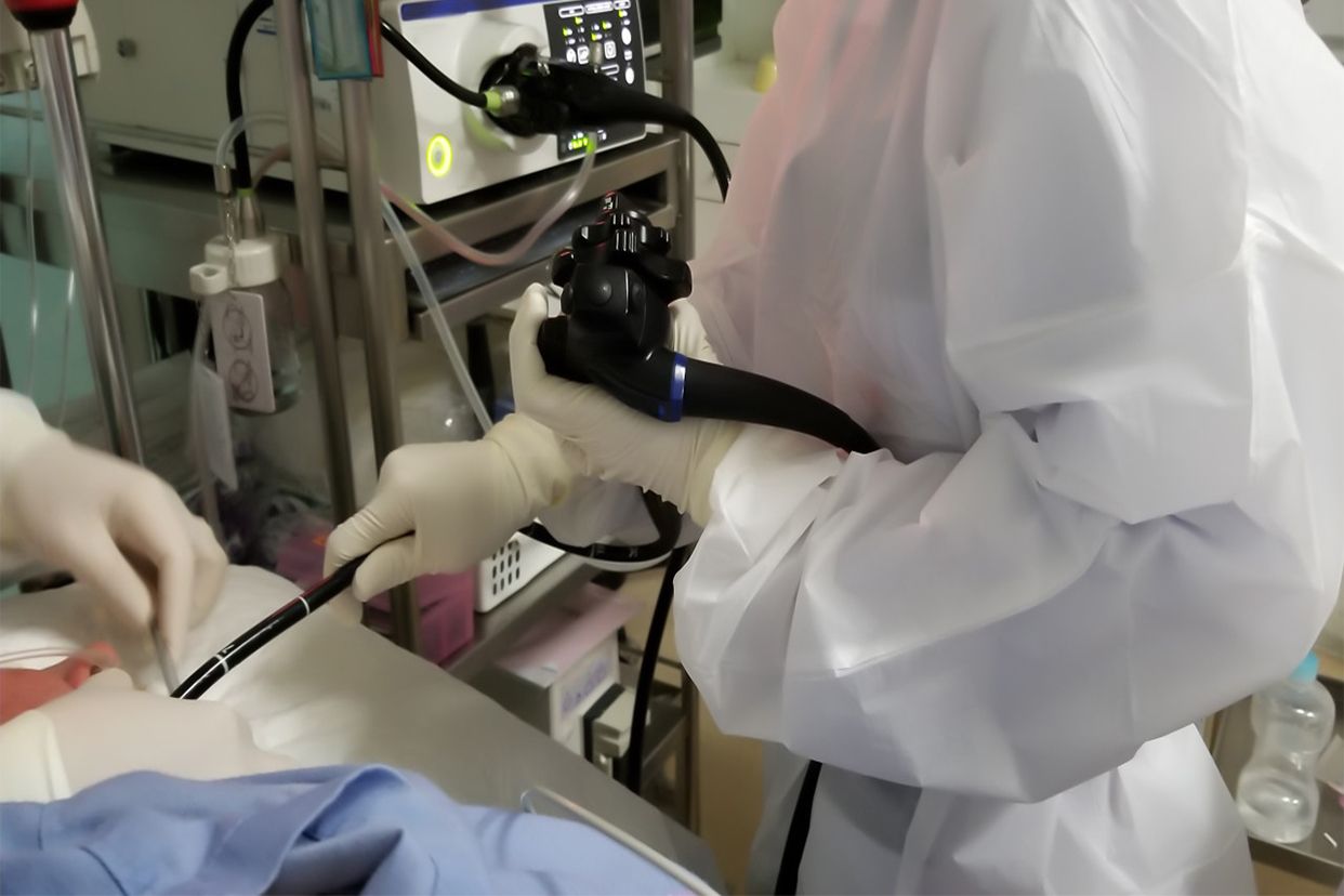 胃静图片真实清晰 胃内部照片